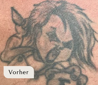 Tattoo vor der Laserbehandlung